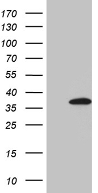 Mouse monoclonal antibody