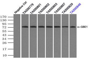 GBE1 Mouse mAb