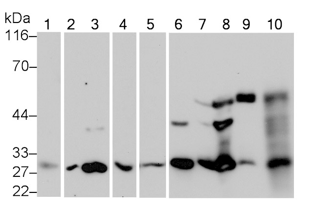 Mouse monoclonal antibody