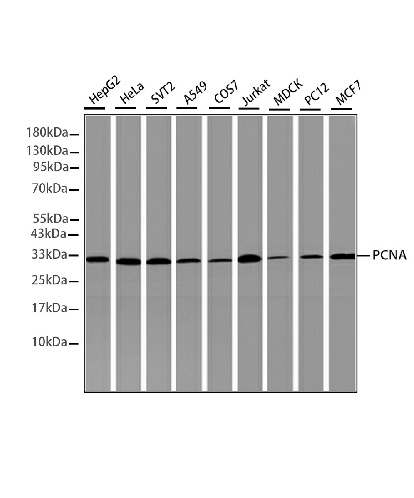 Mouse monoclonal antibody