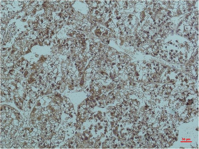 Mouse monoclonal antibody