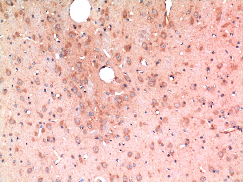 Mouse monoclonal antibody