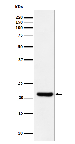 Rabbit monoclonal antibody