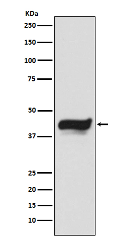 Rabbit monoclonal antibody