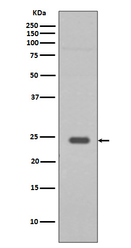 Rabbit monoclonal antibody