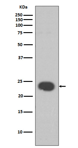 Rabbit monoclonal antibody