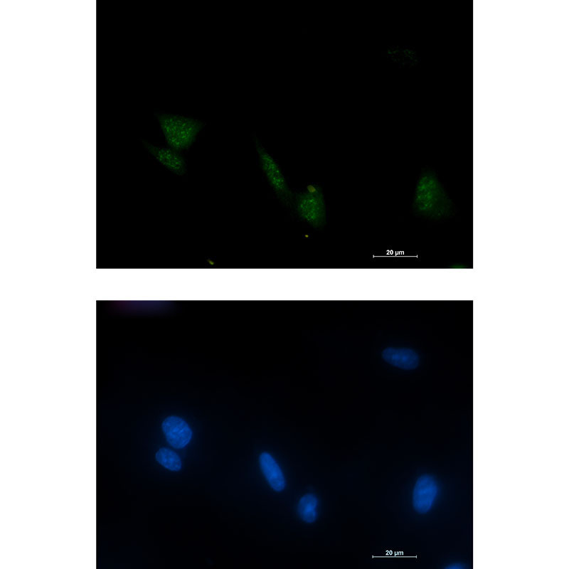 Rabbit monoclonal antibody