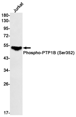 Rabbit monoclonal antibody