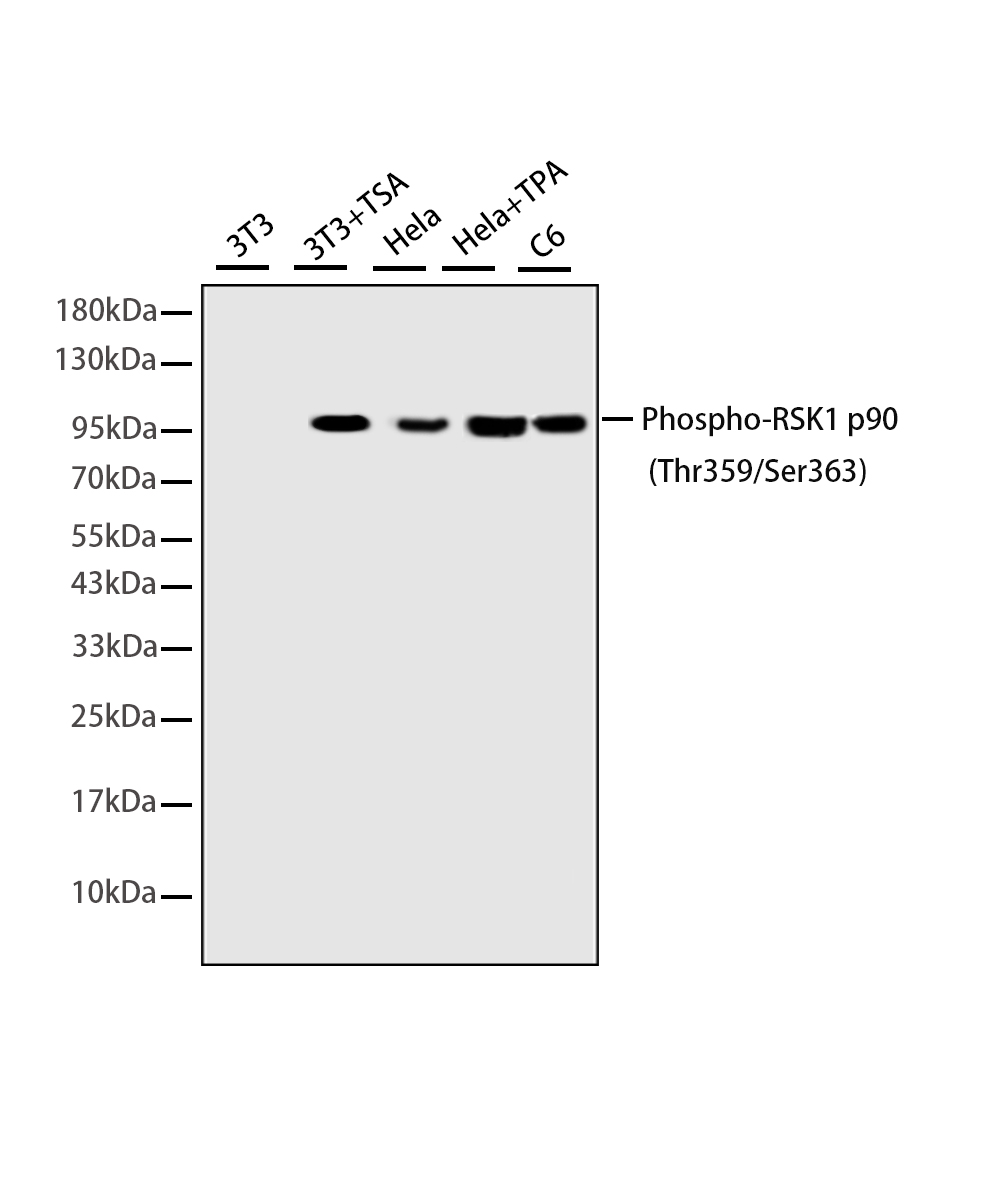 Rabbit monoclonal antibody