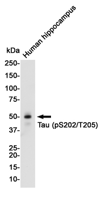 Rabbit monoclonal antibody
