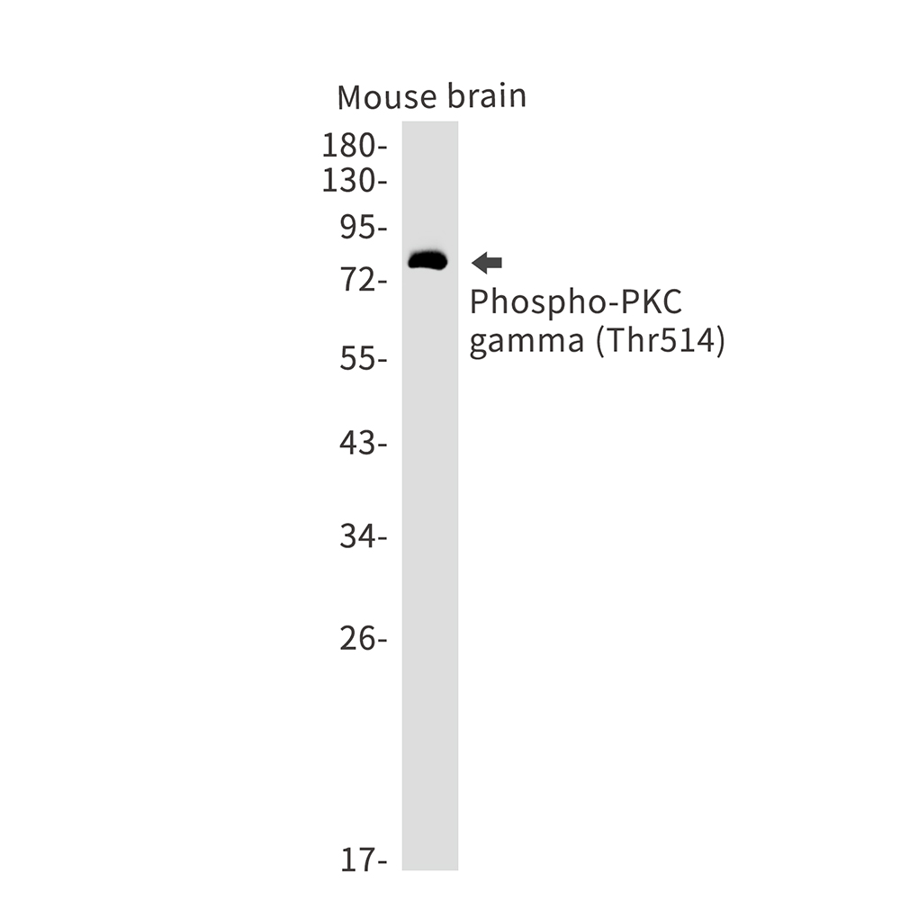 Rabbit monoclonal antibody