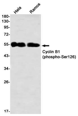 Rabbit monoclonal antibody
