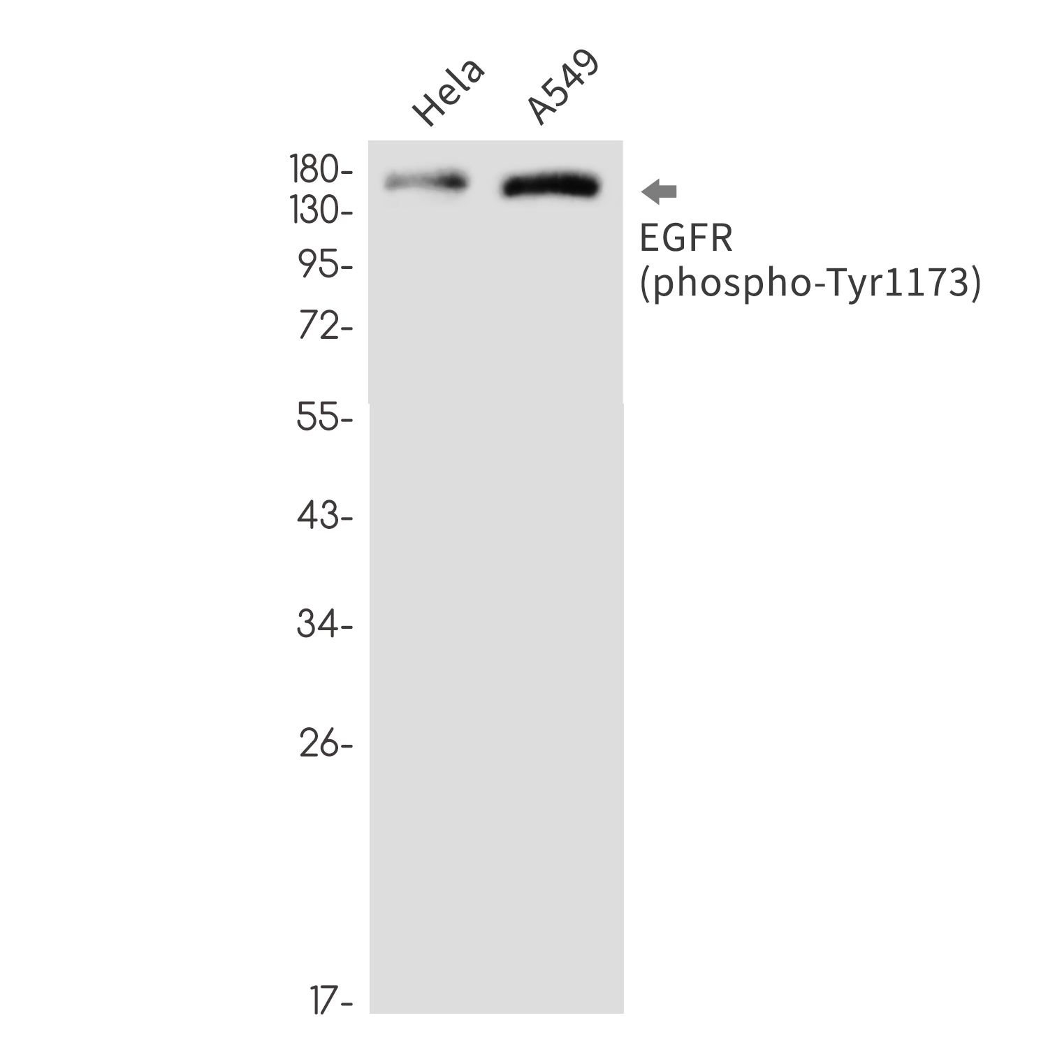 Rabbit monoclonal antibody