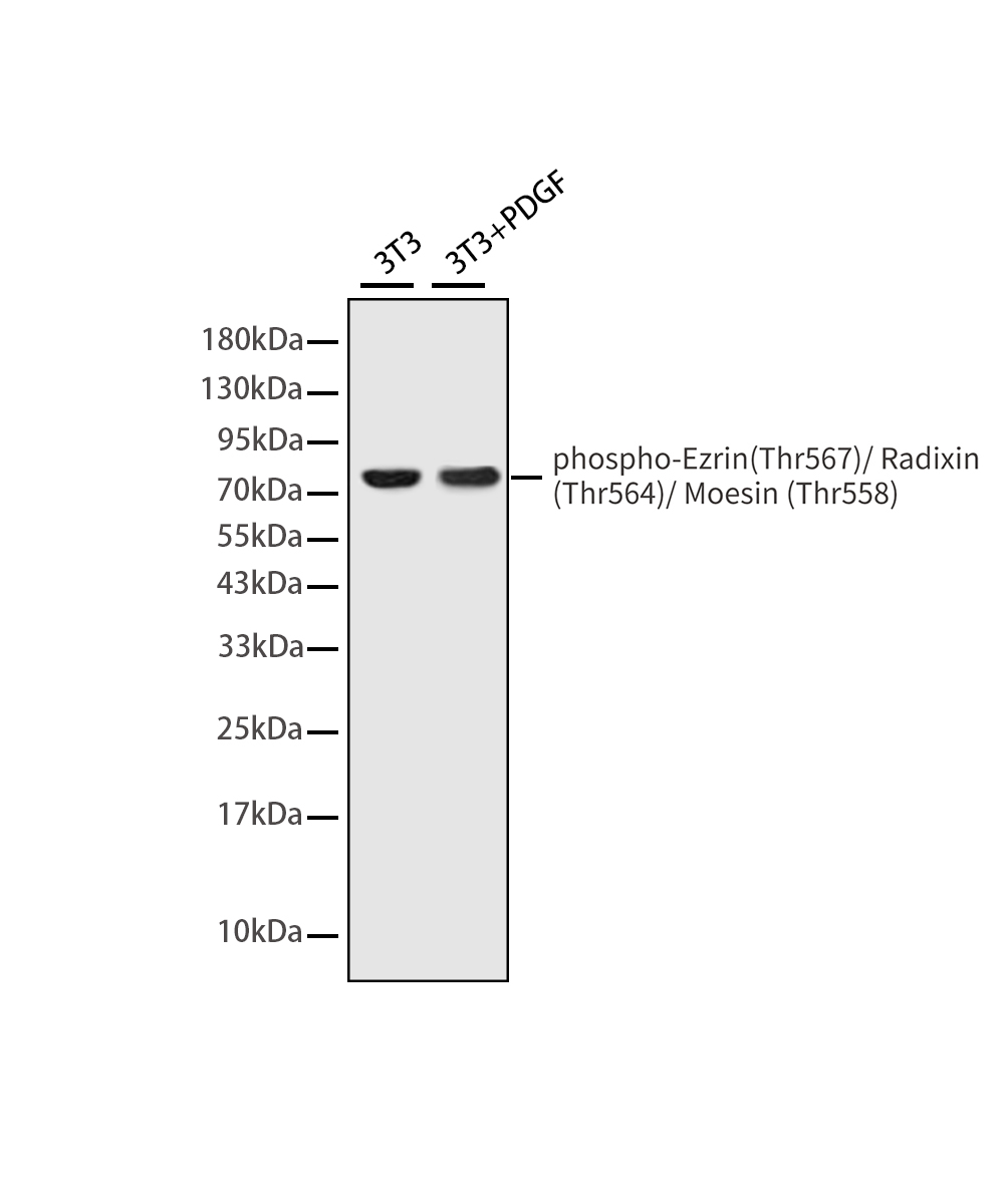 Rabbit monoclonal antibody