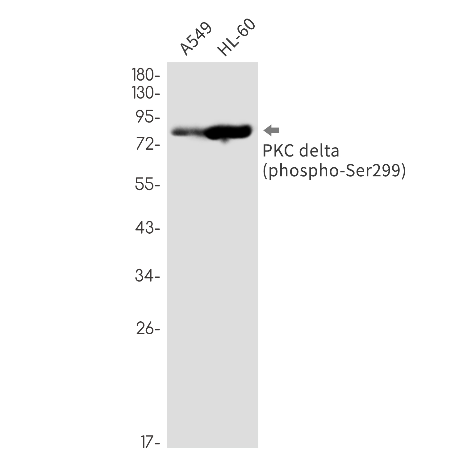 Rabbit monoclonal antibody