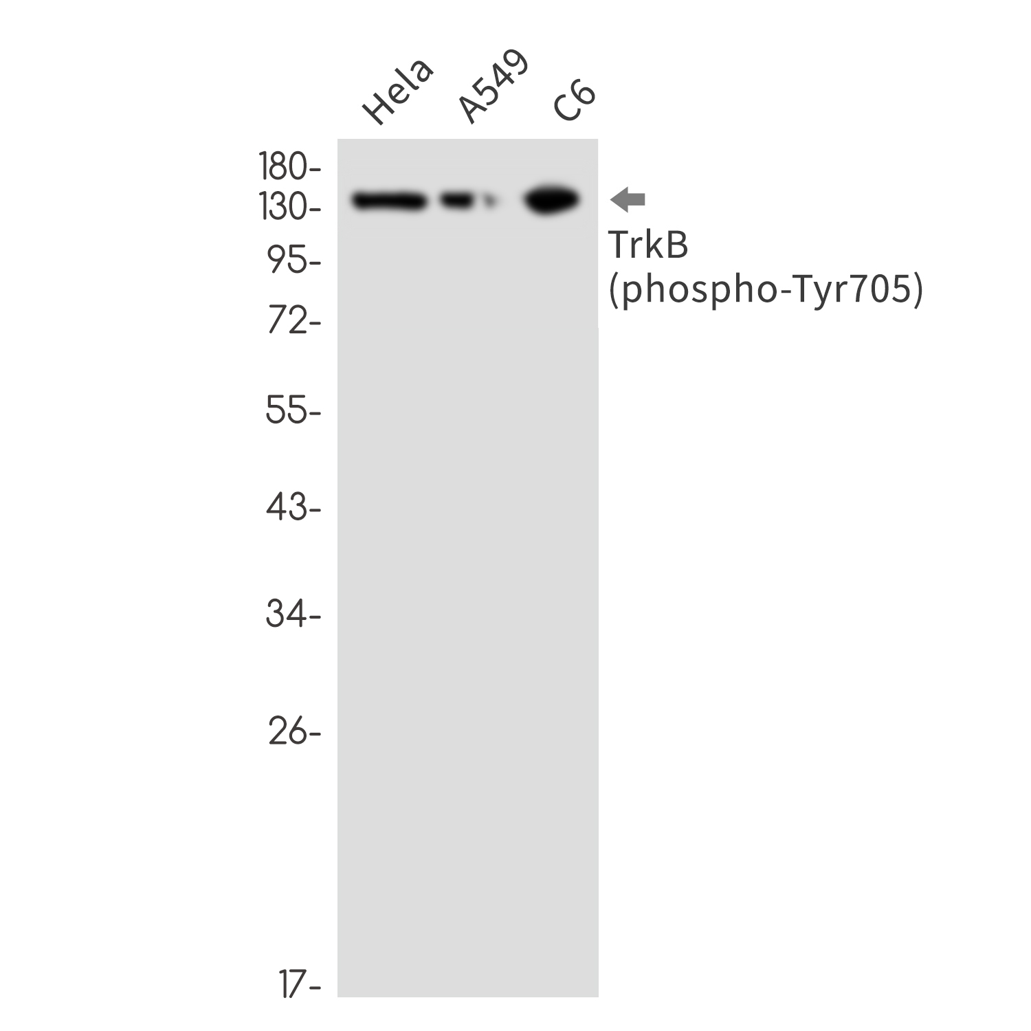 Rabbit monoclonal antibody