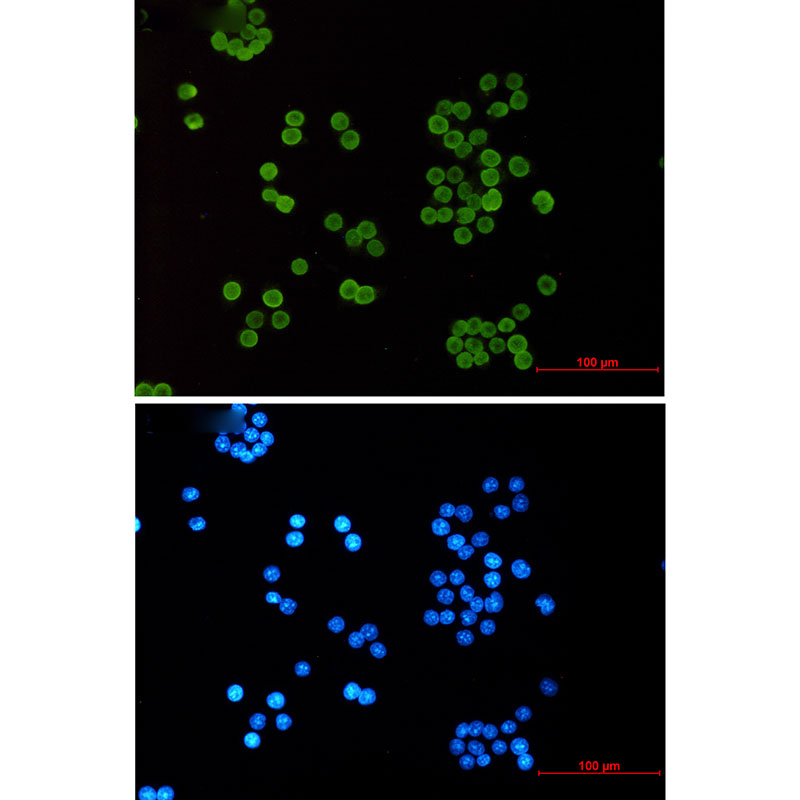 Rabbit monoclonal antibody