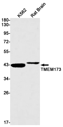 Rabbit monoclonal antibody