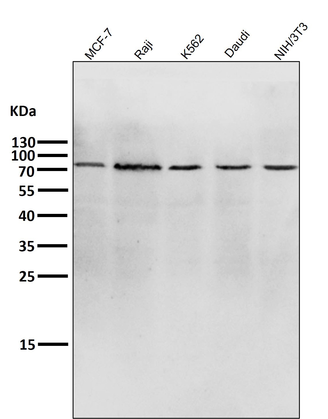Rabbit monoclonal antibody