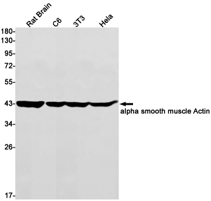 Rabbit monoclonal antibody