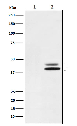 Rabbit monoclonal antibody