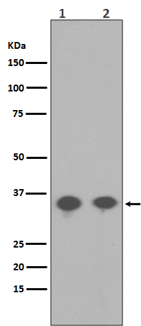 Rabbit monoclonal antibody