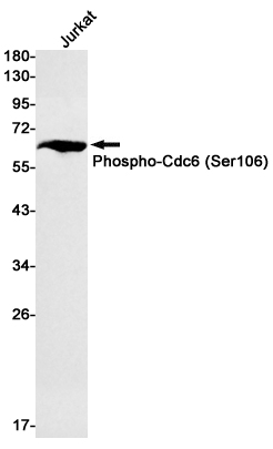 Rabbit monoclonal antibody