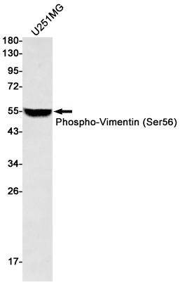 Rabbit monoclonal antibody