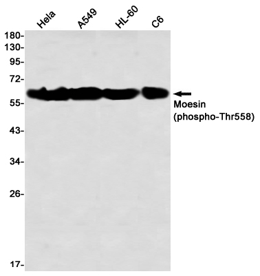 Rabbit monoclonal antibody