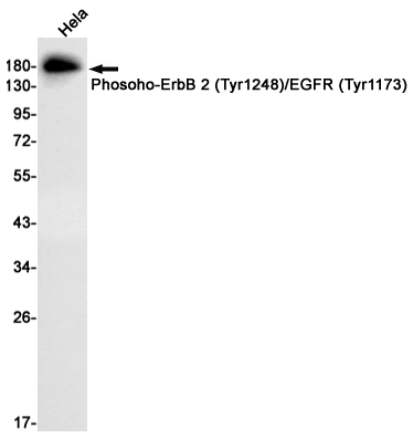 Rabbit monoclonal antibody