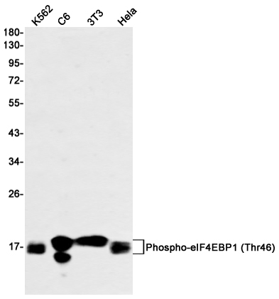 Rabbit monoclonal antibody