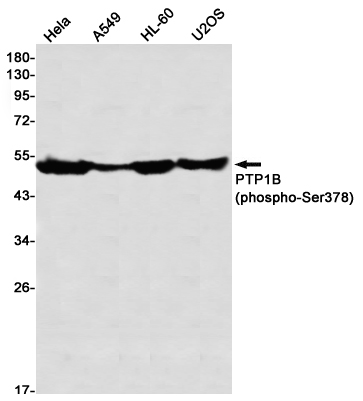 Rabbit monoclonal antibody