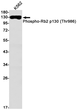 Rabbit monoclonal antibody