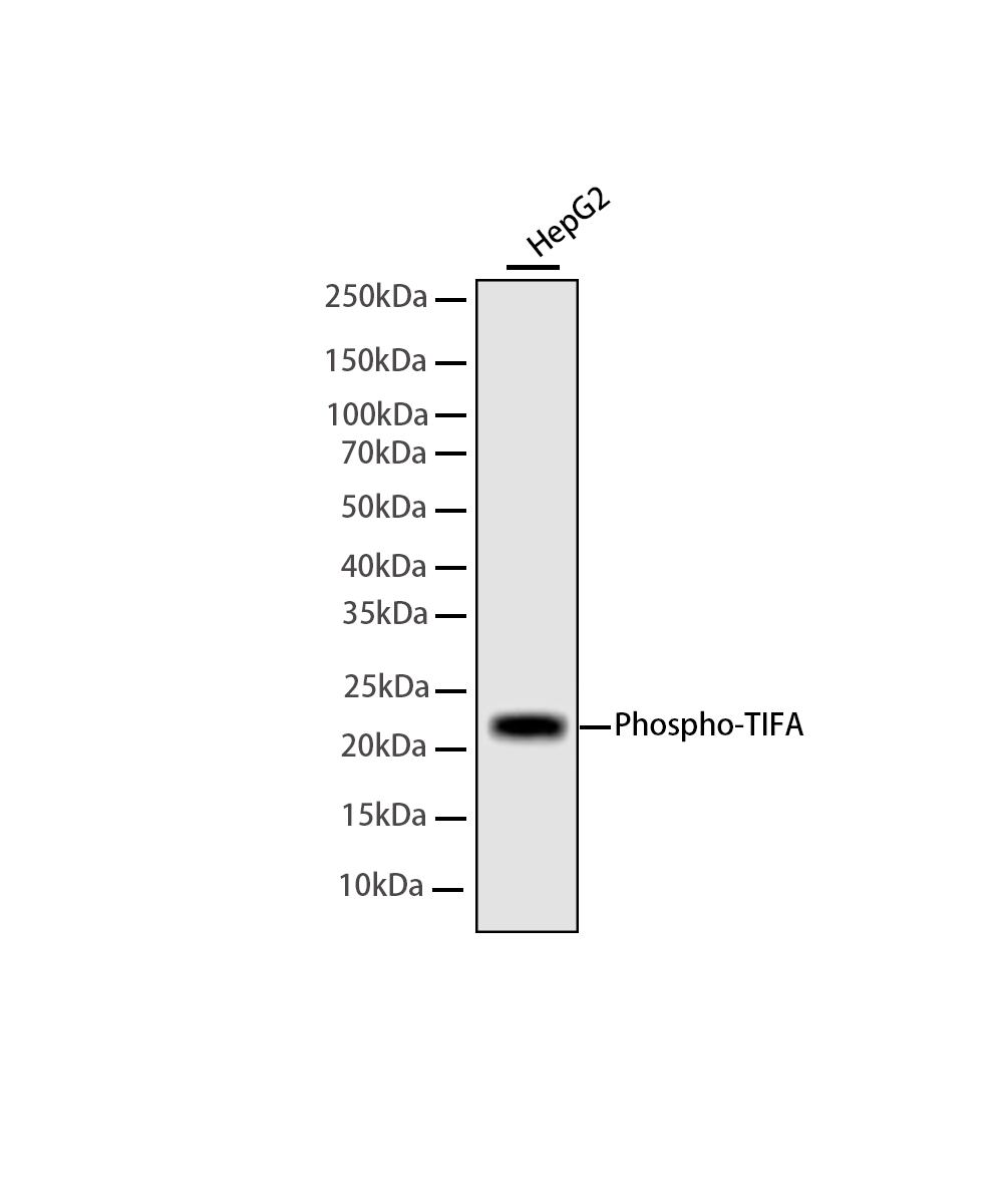 Rabbit monoclonal antibody