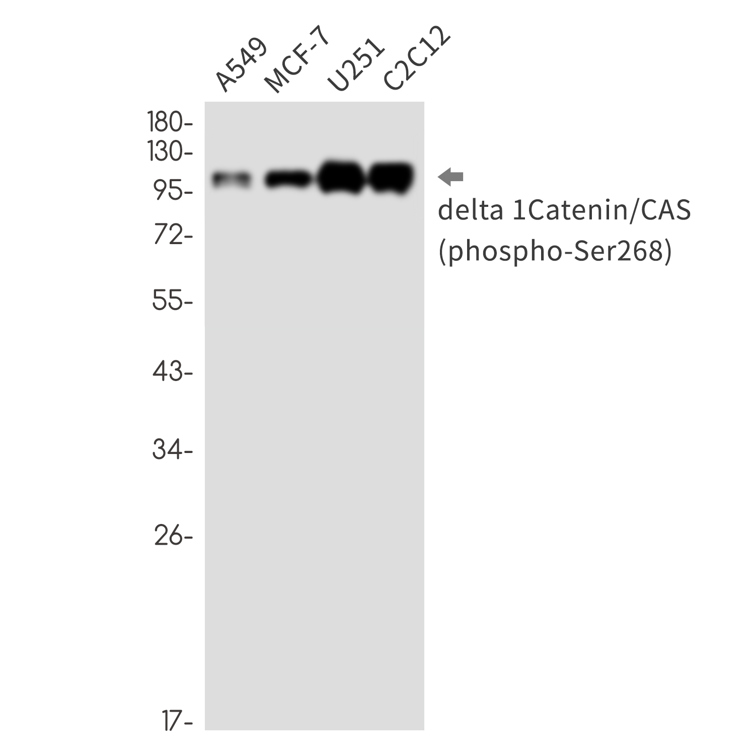 Rabbit monoclonal antibody