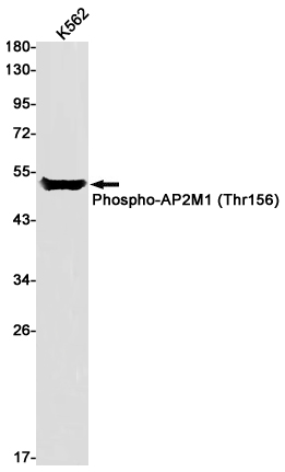 Rabbit monoclonal antibody