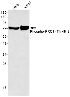 Rabbit monoclonal antibody