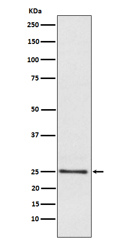 Rabbit monoclonal antibody