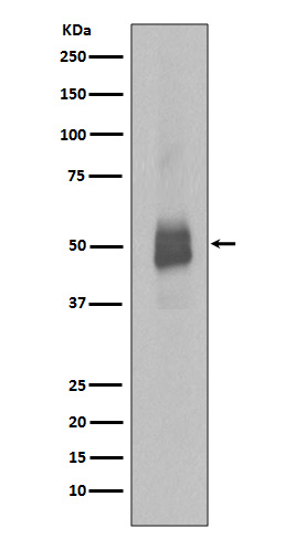 Rabbit monoclonal antibody