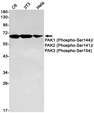 Rabbit monoclonal antibody