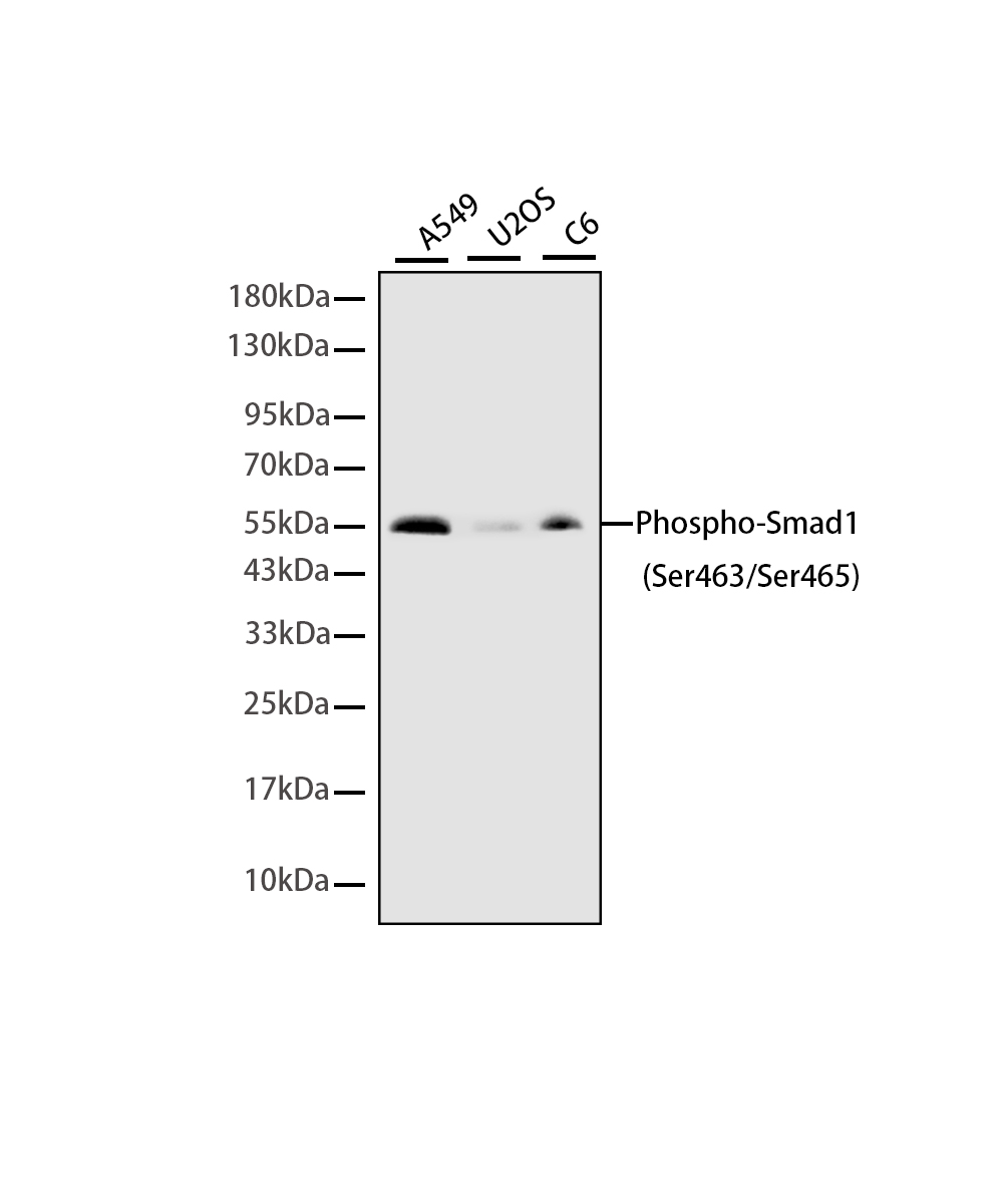 Rabbit monoclonal antibody