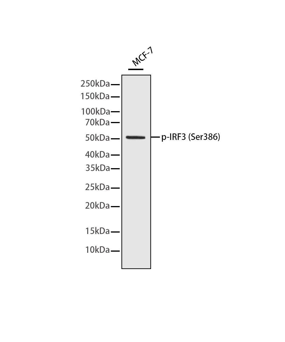 Rabbit monoclonal antibody