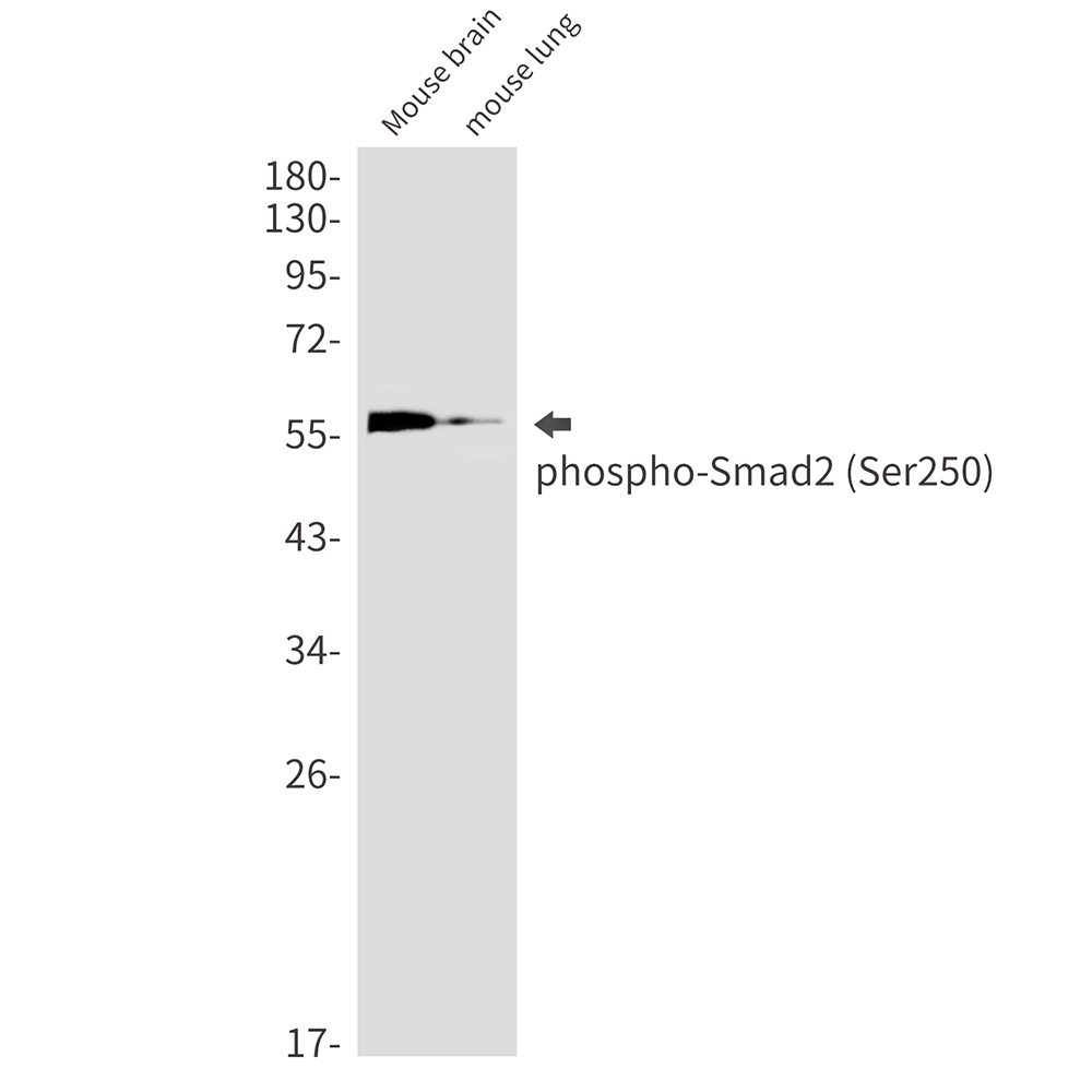 Rabbit monoclonal antibody