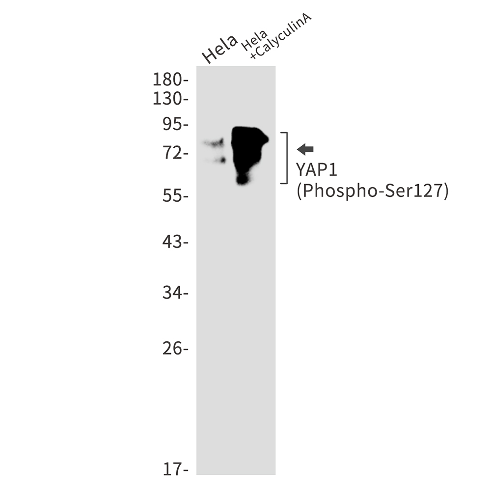 Rabbit monoclonal antibody