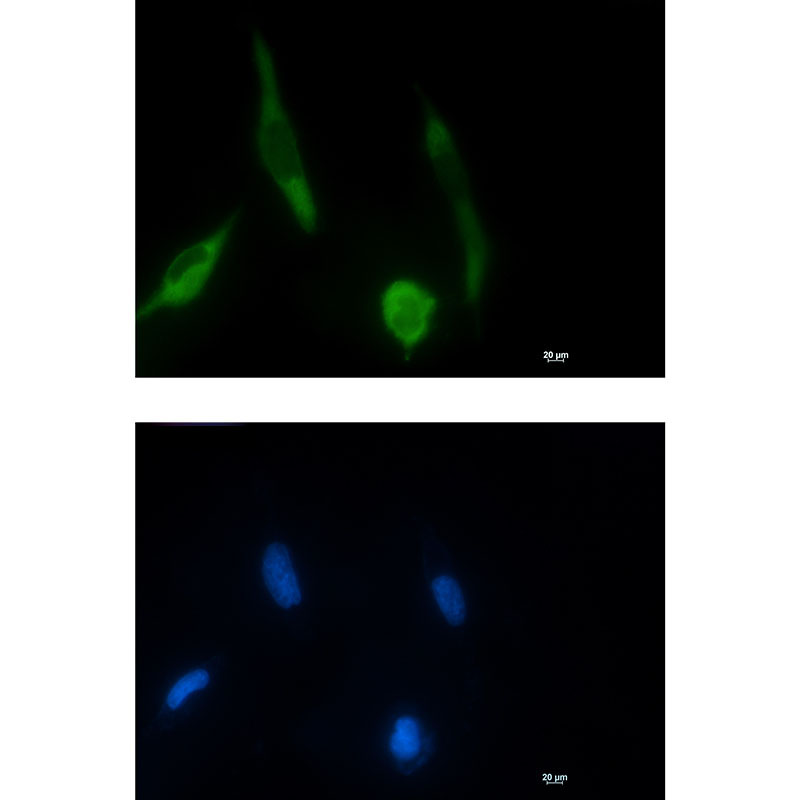 Rabbit monoclonal antibody