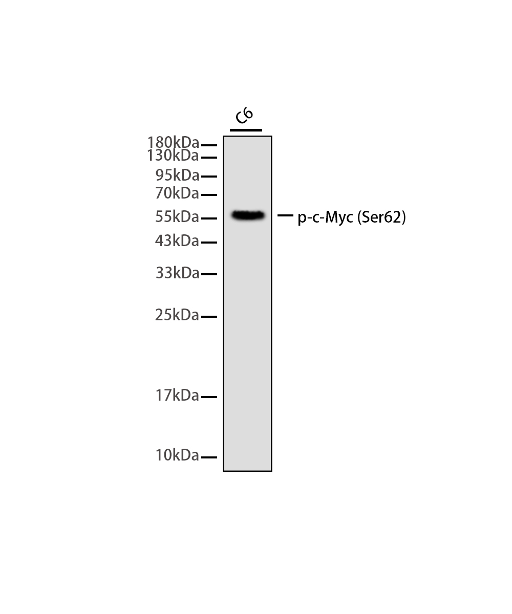 Rabbit monoclonal antibody