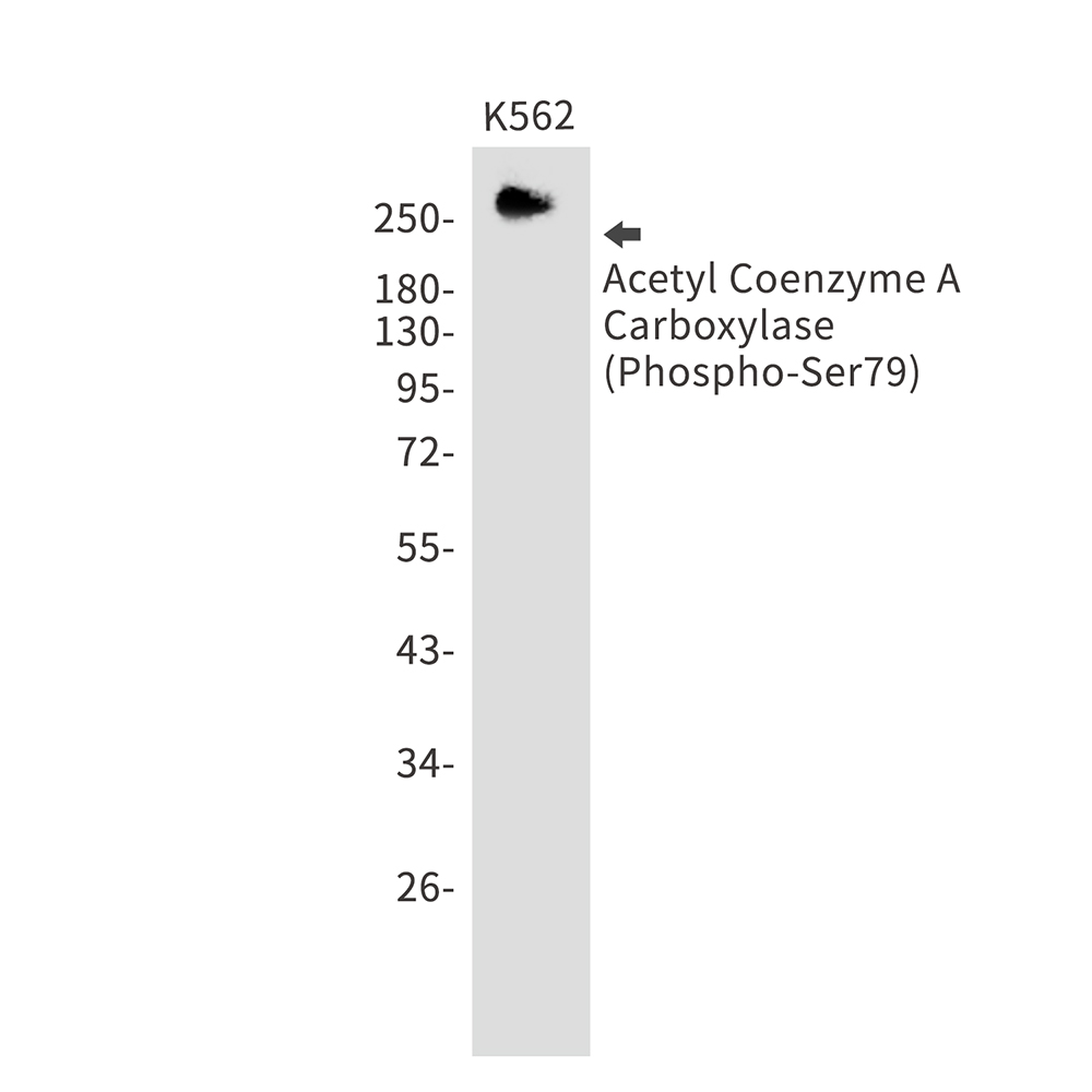Rabbit monoclonal antibody