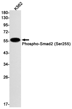 Rabbit monoclonal antibody