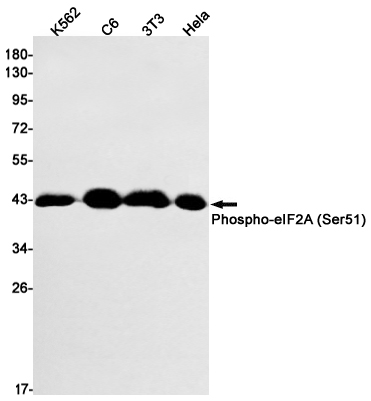 Rabbit monoclonal antibody