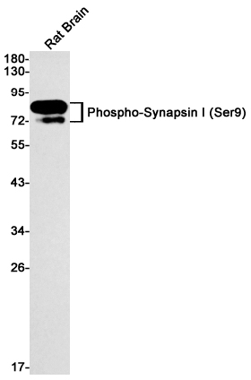 Rabbit monoclonal antibody